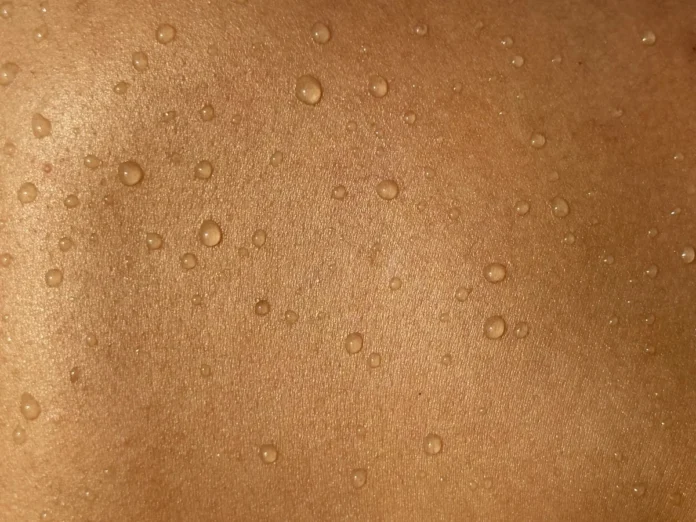 lamotrigine rash pictures - None
